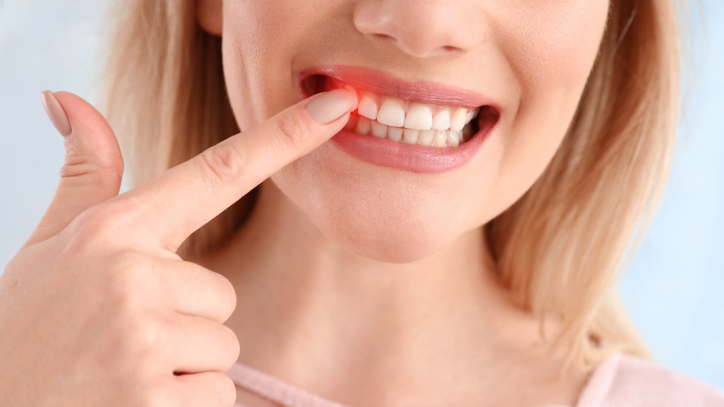 Top 4 Signs of Gum Disease You Should Never Ignore